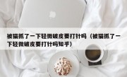 被猫抓了一下轻微破皮要打针吗（被猫抓了一下轻微破皮要打针吗知乎）