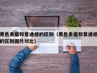 黑色素瘤和普通痣的区别（黑色素瘤和普通痣的区别图片对比）