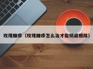 玫瑰糠疹（玫瑰糠疹怎么治才能彻底根除）