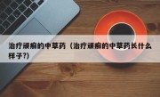 治疗顽癣的中草药（治疗顽癣的中草药长什么样子?）