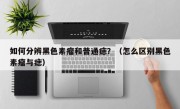 如何分辨黑色素瘤和普通痣？（怎么区别黑色素瘤与痣）